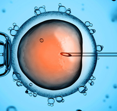 درمان ناباروری IVF و IUI دکتر آتوسا جعفری