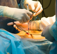 لاپاراسکوپی, هیستروسکوپی دکتر آتوسا جعفری